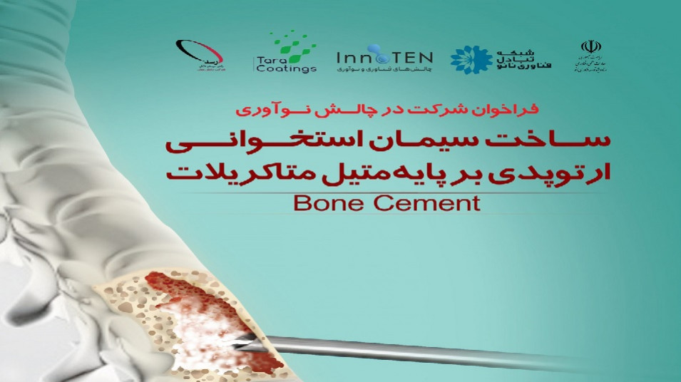 چالش نوآوری؛ ساخت سیمان استخوانی ارتوپدی بر پایه متاکریلات